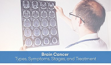 Brain Cancer - Types, Symptoms, Stages, and Treatment